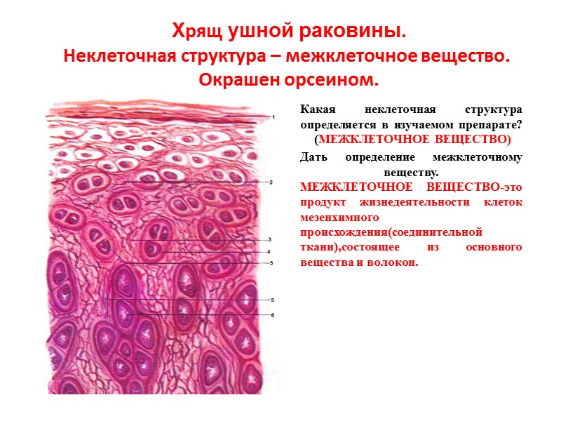 Хрящ ушной раковины. Неклеточная структура – межклеточное вещество.  Окрашен орсеином.  Какая неклеточная